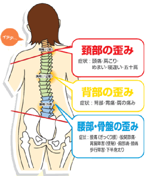 矯正法